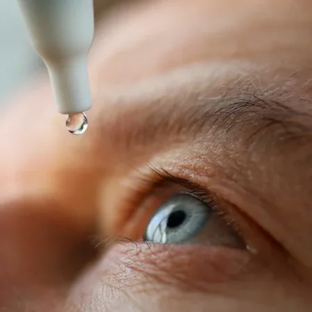 Glaucoma Man Using Eye Drops